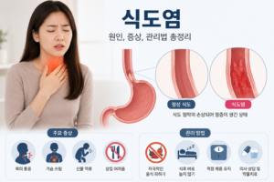 역류성 식도염 영양제 추천|효과적인 성분 종류와 증상별 복용법 총정리 9 식도염